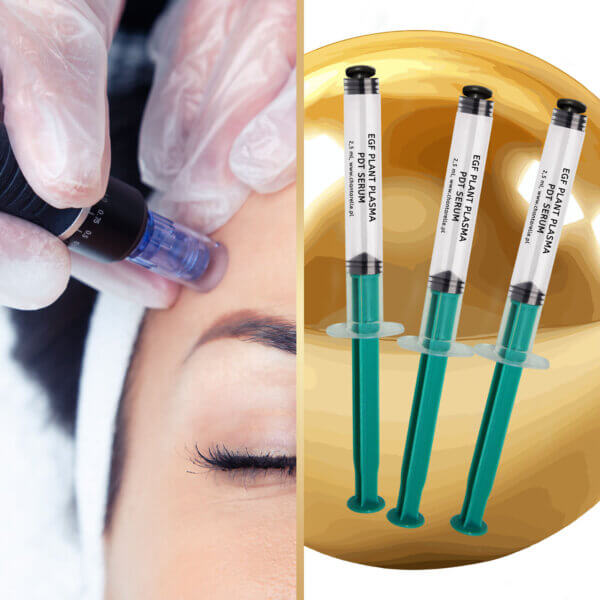 needle mesotherapy